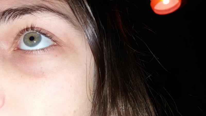 Темные круги под глазами: Как помочь подростку от них избавиться? Рекомендации